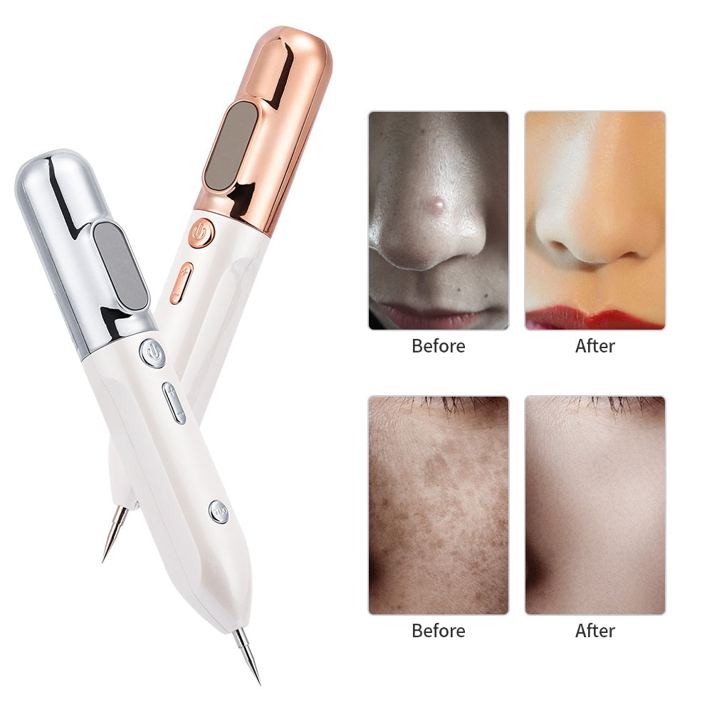 DermaErase™ – Stylo à Plasma pour Élimination des Taches et Marques de Peau