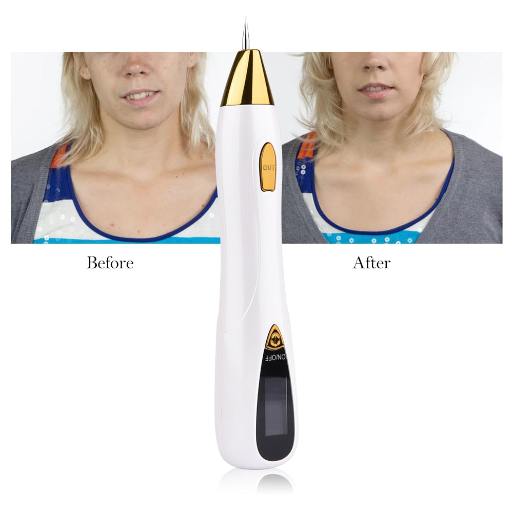 DermaClear™ – Stylo Plasma pour Enlever les Grains de Beauté