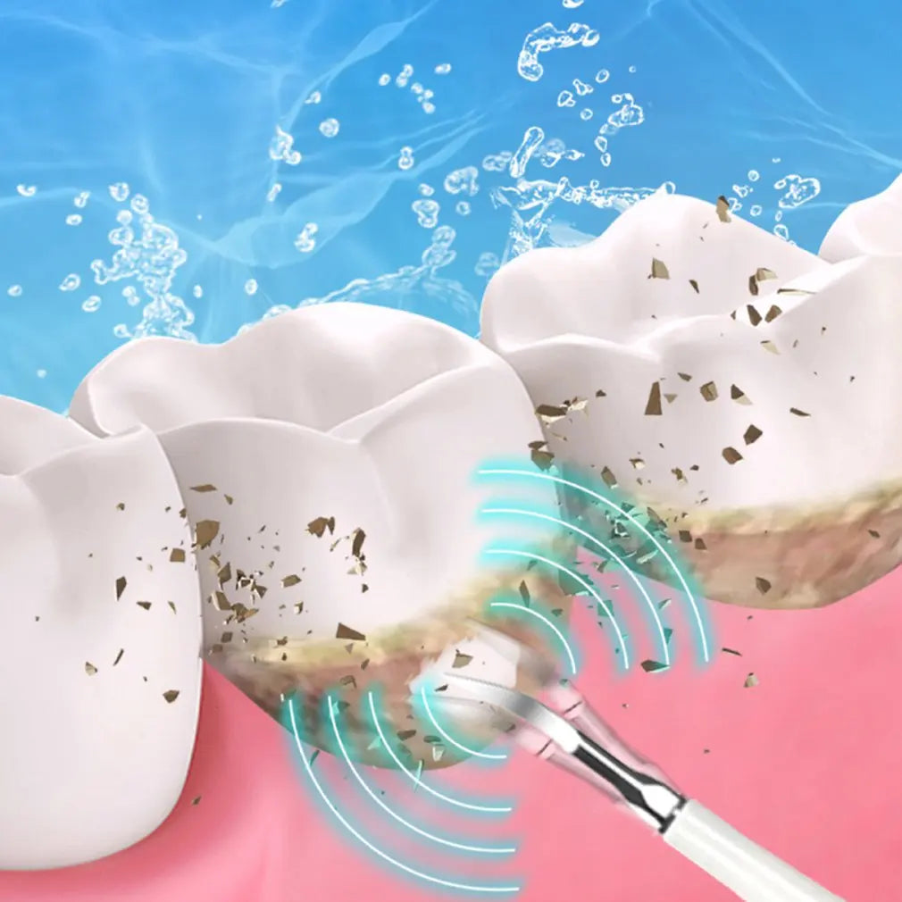 SparkSonic™ – Détartreur Dentaire Sonique avec Irrigation Intégrée